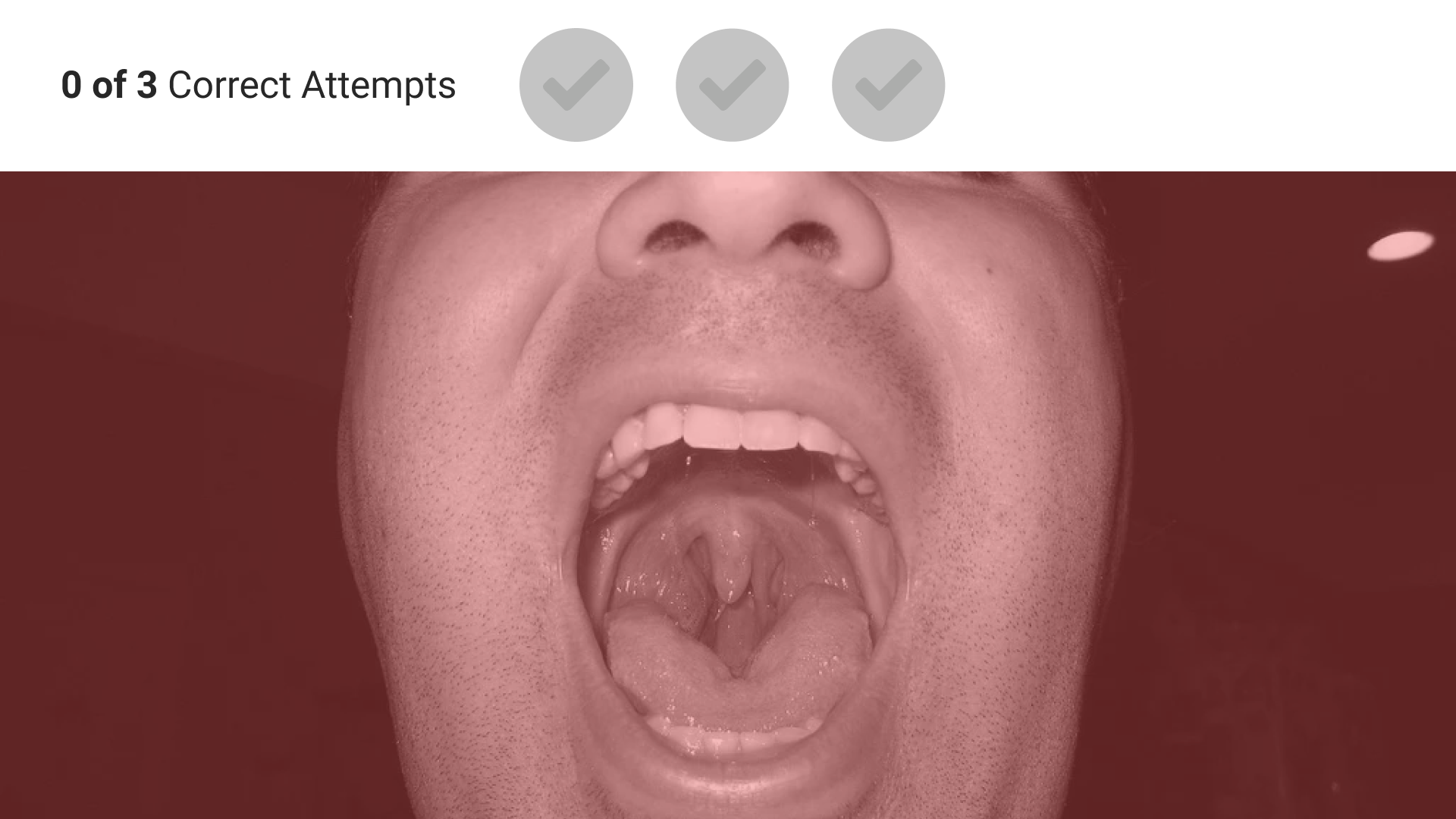 Screen of an open mouth